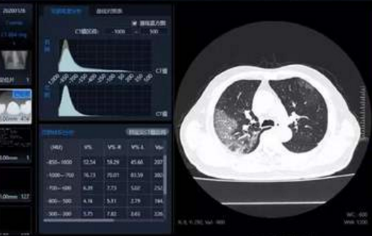 甘肅調(diào)整新冠病毒肺炎確診程序